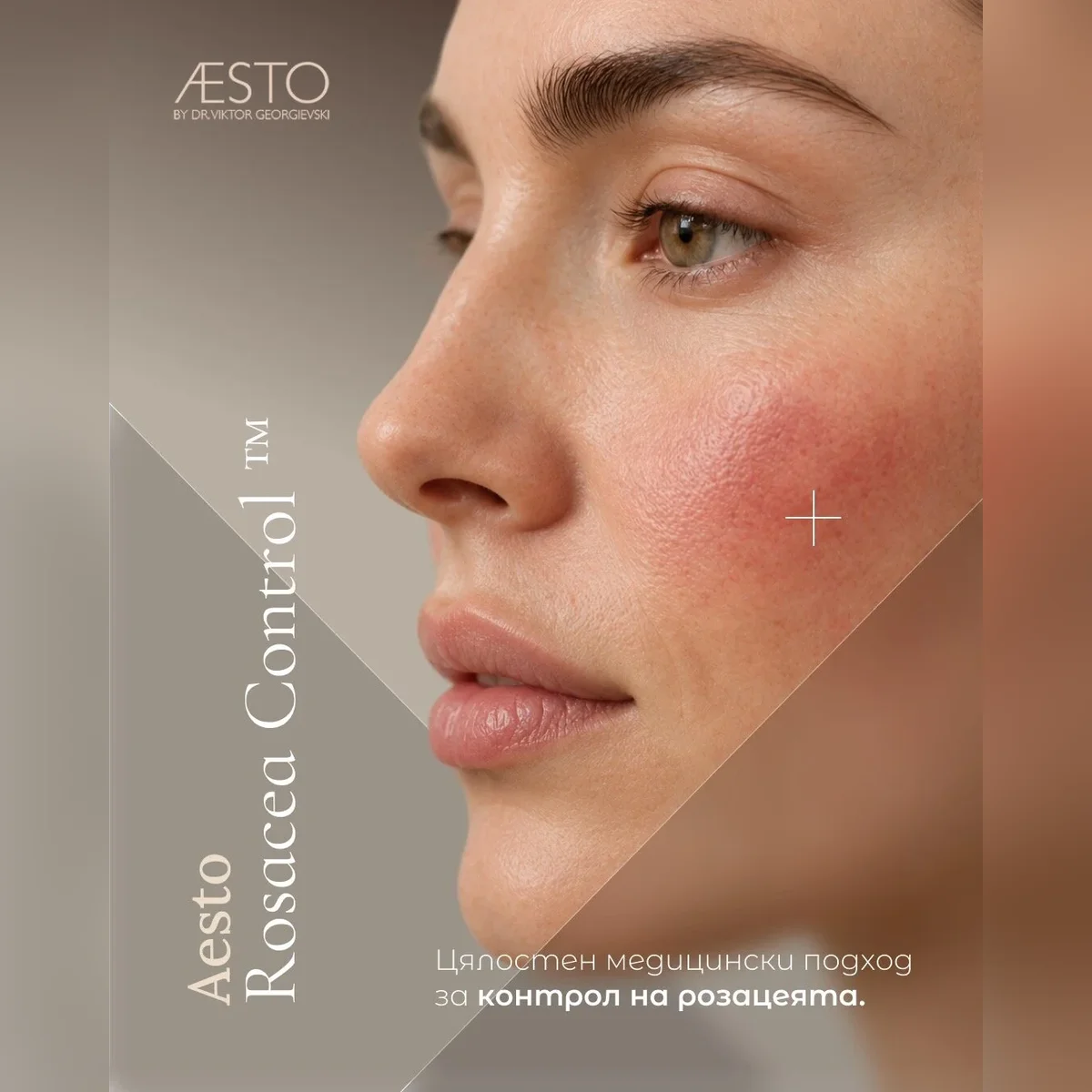 AESTO ROSACEA PROTOCOL™ — Контрол на зачервяването и реактивната кожа