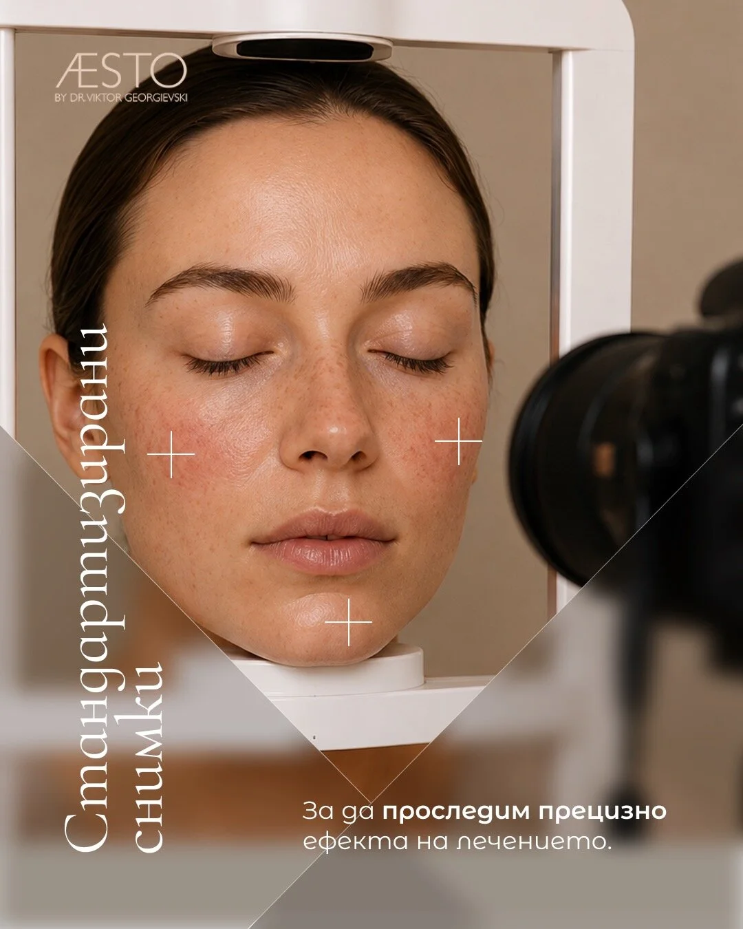 Standardised photographs – to track the effect of the treatment precisely